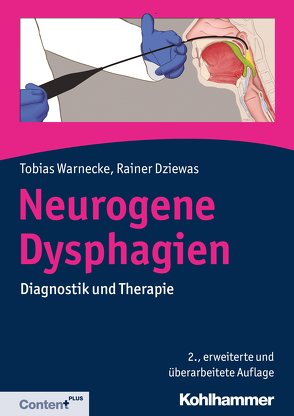 Neurogene Dysphagien von Dziewas,  Rainer, Warnecke,  Tobias