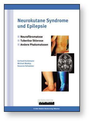 Neurokutane Syndrome und Epilepsie von Kurlemann,  Gerhard, Madeja,  Michael, Schweizer,  Susanne