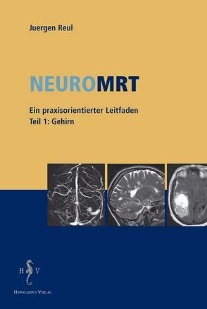 NeuroMRT von Reul,  Juergen