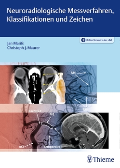 Neuroradiologische Messverfahren, Klassifikationen und Zeichen von Mariß,  Jan, Maurer,  Christoph J.