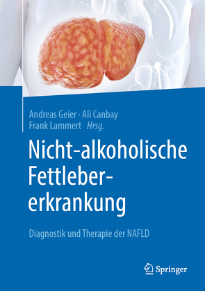 Nicht-alkoholische Fettlebererkrankung von Canbay,  Ali, Geier,  Andreas, Lammert,  Frank
