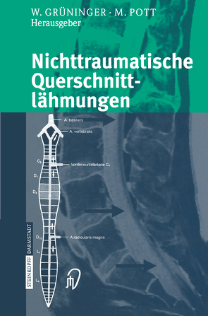 Nichttraumatische Querschnittlähmungen von Grüninger,  Werner, Pott,  Michael