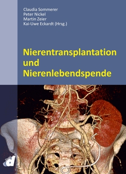 Nierentransplantation und Nierenlebendspende von Eckardt,  Kai-Uwe, Nickel,  Peter, Sommerer,  Claudia, Zeier,  Martin
