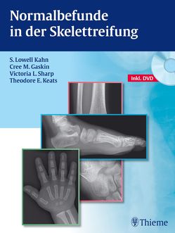 Normalbefunde in der Skelettreifung von Gaskin,  Cree M., Kahn,  S. Lowell, Keats,  Theodore E., Sharp,  Victoria L.