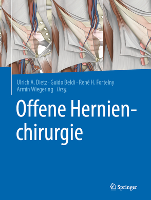 Offene Hernienchirurgie von Beldi,  Guido, Dietz,  Ulrich A, Fortelny,  René H., Wiegering,  Armin