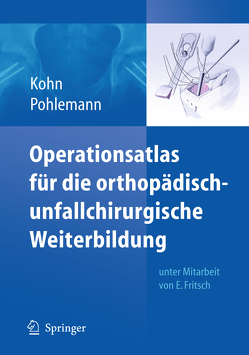 Operationsatlas für die orthopädisch-unfallchirurgische Weiterbildung von Fritsch,  Ekkehard W., Kohn,  Dieter, Kühn,  Jörg, Pohlemann,  Tim