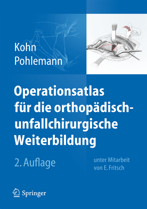 Operationsatlas für die orthopädisch-unfallchirurgische Weiterbildung von Fritsch,  Ekkehard W., Kohn,  Dieter, Pohlemann,  Tim