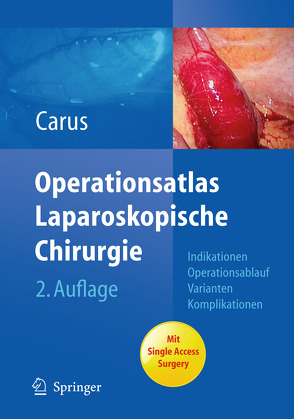 Operationsatlas Laparoskopische Chirurgie von Carus,  Thomas