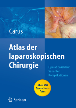 Operationsatlas Laparoskopische Chirurgie von Carus,  Thomas