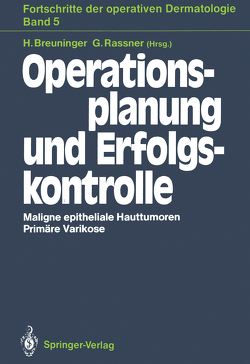 Operationsplanung und Erfolgskontrolle von Breuninger,  Helmut, Rassner,  Gernot