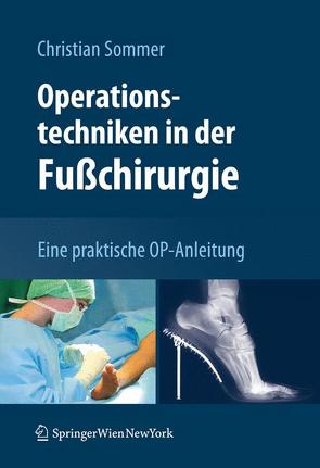Operationstechniken in der Fußchirurgie von Sommer,  Christian