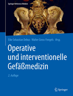 Operative und interventionelle Gefäßmedizin von Debus,  Eike Sebastian, Gross-Fengels,  Walter