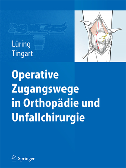 Operative Zugangswege in Orthopädie und Unfallchirurgie von Lüring,  Christian, Tingart,  Markus