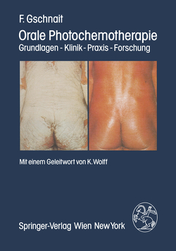 Orale Photochemotherapie von Gschnait,  F., Wolff,  K.