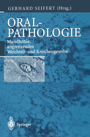 Oralpathologie von Burkhardt,  A., Morgenroth,  K., Seifert,  G., Seifert,  Gerhard