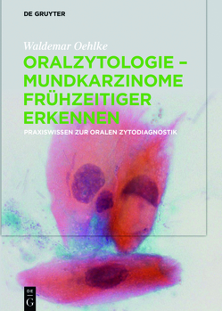 Oralzytologie – Mundkarzinome frühzeitiger erkennen von Oehlke,  Waldemar