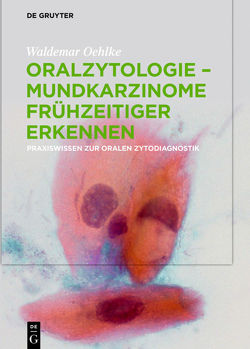 Oralzytologie – Mundkarzinome frühzeitiger erkennen von Oehlke,  Waldemar