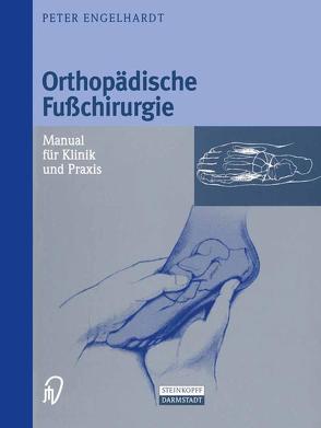 Orthopädische Fußchirurgie von Engelhardt,  Peter