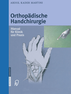 Orthopädische Handchirurgie von Martini,  Abdul Kader