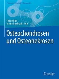 Osteochondrosen und Osteonekrosen von Engelhardt,  Martin, Hotfiel,  Thilo
