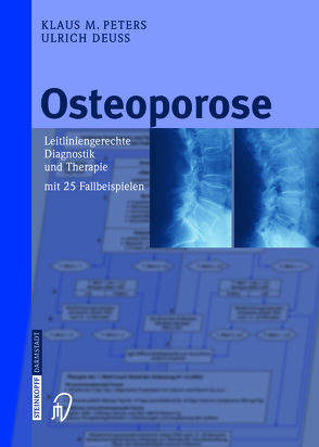 Osteoporose von Deuß,  Ulrich, Peters,  Klaus M.