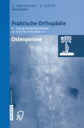 Osteoporose von Götte,  Siegfried, Hedtmann,  Achim