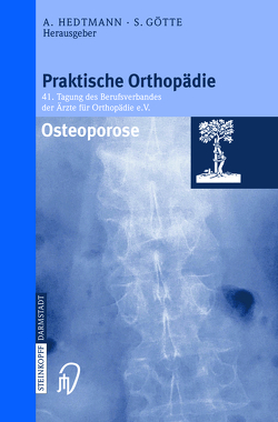 Osteoporose von Götte,  Siegfried, Hedtmann,  Achim