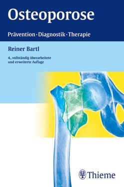 Osteoporose von Bartl,  Reiner