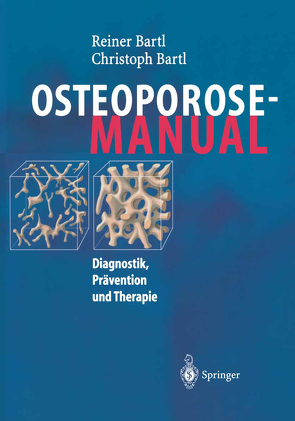 Osteoporose-Manual von Bartl,  Christoph, Bartl,  Reiner