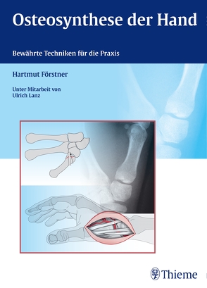 Osteosynthese der Hand von Förstner,  Hartmut