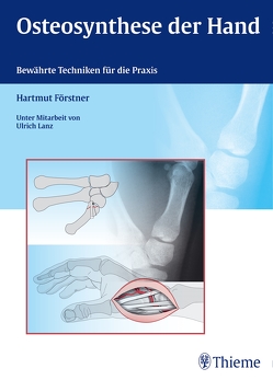 Osteosynthese der Hand von Förstner,  Hartmut