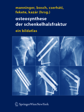 Osteosynthese der Schenkelhalsfraktur von Bosch,  Ulrich, Cserháti,  Péter, Fekete,  Karoly, Kazar,  György, Manninger,  Jenö