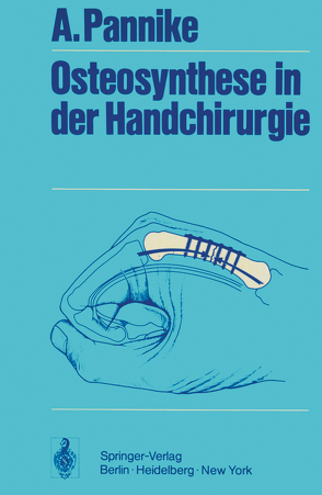 Osteosynthese in der Handchirurgie von Pannike,  A.