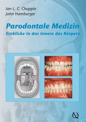 Parodontale Medizin von Chapple,  Ian L. C., Hamburger,  John