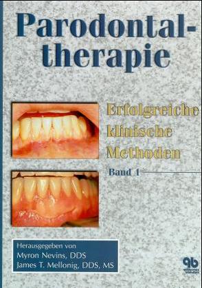 Parodontaltherapie. Erfolgreiche klinische Methoden / Parodontaltherapie von Mellonig,  James T, Nevins,  Myron