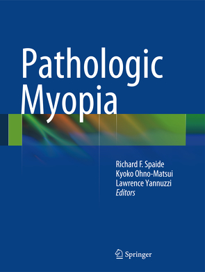Pathologic Myopia von Ohno-Matsui,  Kyoko, Spaide,  Richard F, Yannuzzi,  Lawrence A.