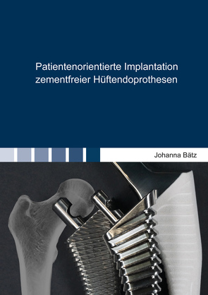 Patientenorientierte Implantation zementfreier Hüftendoprothesen von Bätz,  Johanna