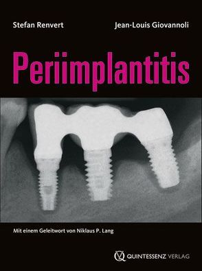 Periimplantitis von Giovannoli,  Jean-Louis, Renvert,  Stefan