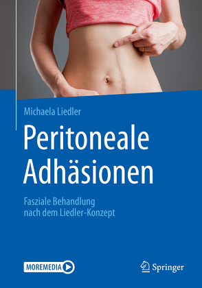 Peritoneale Adhäsionen von Liedler,  Michaela