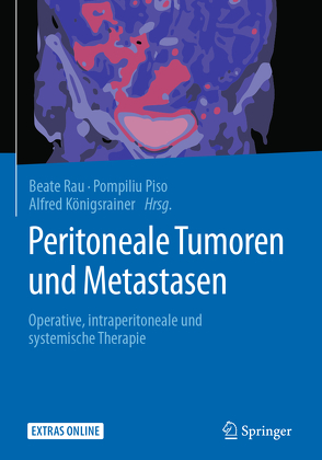 Peritoneale Tumoren und Metastasen von Königsrainer,  Alfred, Piso,  Pompiliu, Rau,  Beate