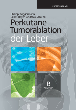 Perkutane Tumorablation der Leber von Beyer,  Lukas, Schicho,  Andreas, Wiggermann,  Philipp
