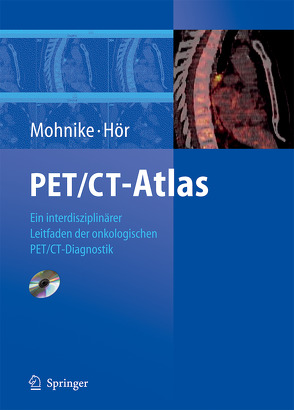 PET/CT-Atlas von Beyer,  T., Hör,  Gustav, Käpplinger,  S., Mohnike,  K., Mohnike,  Wolfgang, Schelbert,  Heinrich