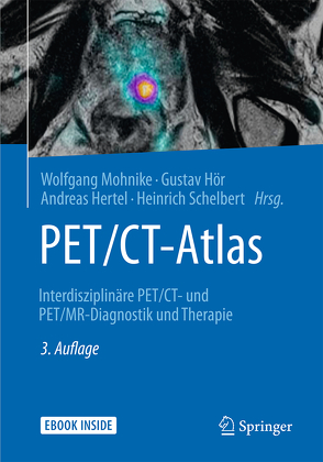 PET/CT-Atlas von Hertel,  Andreas, Hör,  Gustav, Mohnike,  Wolfgang, Schelbert,  Heinrich