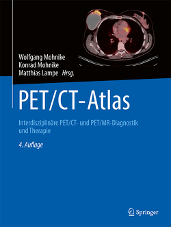 PET/CT-Atlas von Lampe,  Matthias, Mohnike,  Konrad, Mohnike,  Wolfgang