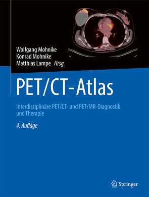 PET/CT-Atlas von Lampe,  Matthias, Mohnike,  Konrad, Mohnike,  Wolfgang