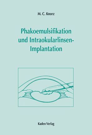 Phakoemulsifikation und Intraokularlinsen-Implantation von Knorz,  M C