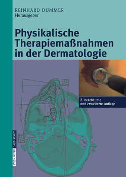Physikalische Therapiemaßnahmen in der Dermatologie von Dummer,  Reinhard