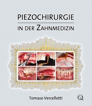 Piezochirurgie in der Zahnmedizin von Vercellotti,  Tomaso