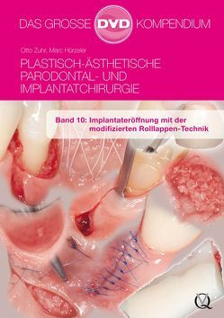 Plastisch-Ästhetische Parodontal- und Implantatchirurgie / Plastisch-Ästhetische Parodontal- und Implantatchirurgie von Hürzeler,  Marc, Zuhr,  Otto