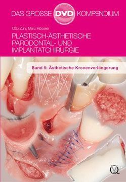 Plastisch-Ästhetische Parodontal- und Implantatchirurgie von Hürzeler,  Marc, Zuhr,  Otto